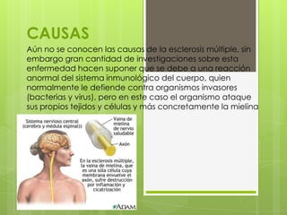 CAUSAS
Aún no se conocen las causas de la esclerosis múltiple, sin
embargo gran cantidad de investigaciones sobre esta
enfermedad hacen suponer que se debe a una reacción
anormal del sistema inmunológico del cuerpo, quien
normalmente le defiende contra organismos invasores
(bacterias y virus), pero en este caso el organismo ataque
sus propios tejidos y células y más concretamente la mielina
 
