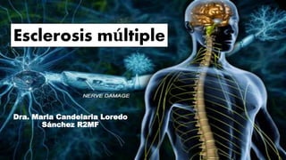 Esclerosis múltiple
Dra. Maria Candelaria Loredo
Sánchez R2MF
 