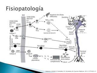 Esclerosis múltiple O. Fernández, V.E. Fernández y M. Guerrero-Medicine. 2015;11(77):4610-21
 