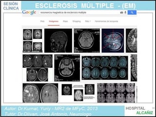 Esclerosis Multiple: recorrido basico