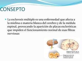 CONSEPTO
 La esclerosis múltiple es una enfermedad que afecta a

la mielina o materia blanca del cerebro y de la médula
espinal, provocando la aparición de placas escleróticas
que impiden el funcionamiento normal de esas fibras
nerviosas

 