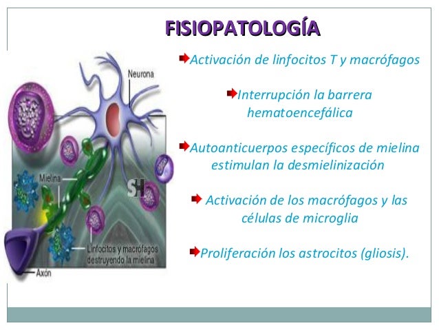 Esclerosis Multiple