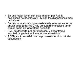 <ul><li>En una mujer joven con esta imagen por RMI la posibilidad de neoplasia y EM son los diagnósticos mas probables. </...