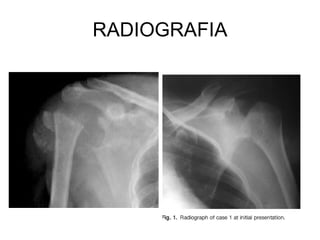 RADIOGRAFIA 