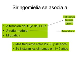 Siringomielia se asocia a  