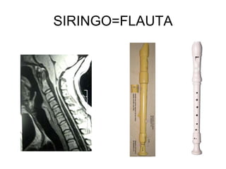 SIRINGO=FLAUTA 