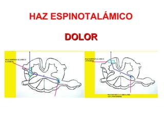 HAZ ESPINOTALÁMICO DOLOR 