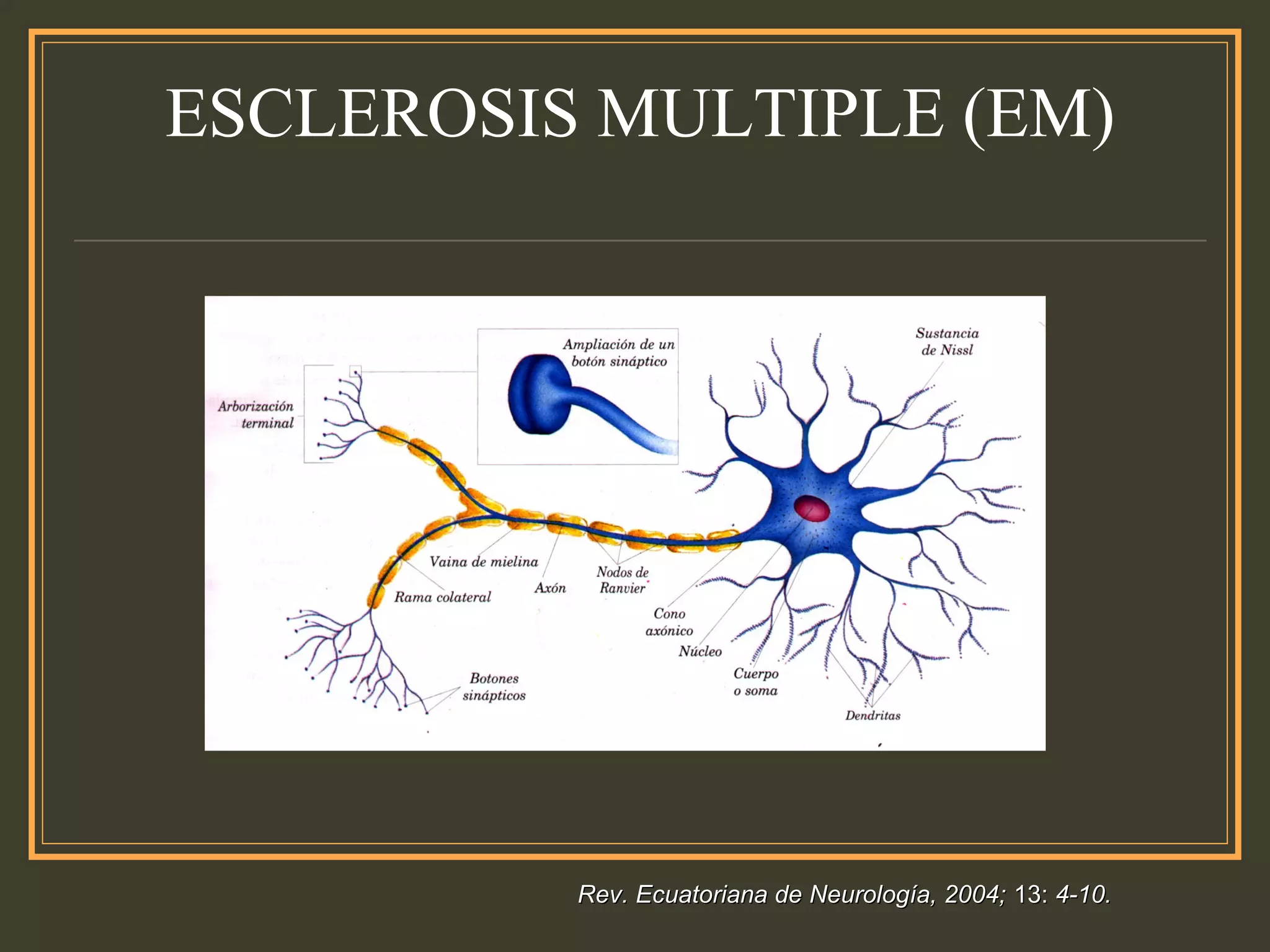 ESCLEROSIS MULTIPLE (EM)
Rev. Ecuatoriana de Neurología, 2004;Rev. Ecuatoriana de Neurología, 2004; 13:13: 4-10.4-10.
 