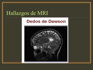Hallazgos de MRI
 
