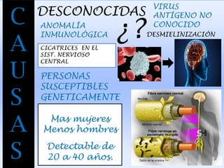 C
A
U
S
A
S
DESCONOCIDAS
VIRUS
ANTÍGENO NO
CONOCIDOANOMALÍA
INMUNOLÓGICA ¿?DESMIELINIZACIÓN
CICATRICES EN EL
SIST. NERVIOSO
CENTRAL
PERSONAS
SUSCEPTIBLES
GENETICAMENTE
Mas mujeres
Menos hombres
Detectable de
20 a 40 años.
 