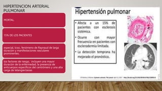 HIPERTENCION ARTERIAL
PULMONAR
MORTAL.
15% DE LOS PACIENTES
especial, lcssc, fenómeno de Raynaud de larga
duración y manifestaciones vasculares
prominentes.
los factores de riesgo, incluyen una mayor
duración de la enfermedad, la presencia de
anticuerpos específicos del centrómero y una alta
carga de telangiectasias
 