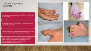 ULCERAS ISQUEMICAS
DIGITALES
Ocurren en aproximadamente el 90 % y el 40 % de
los pacientes
Morbilidad sustancial con dolor y limitación de la
función de la mano
Los antagonistas de la endotelina parecen ser útiles
para prevenir las úlceras isquémicas digitales,
Opciones de tratamiento, nitratos tópicos (FR),
inyecciones intradigitales de toxina botulínica
(isquemia digital severa y ulceración) y
prostanoides intravenosos (ID)
 