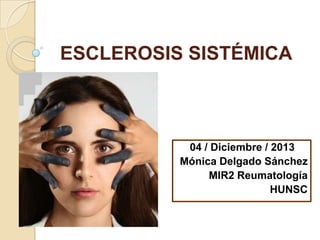 ESCLEROSIS SISTÉMICA

04 / Diciembre / 2013
Mónica Delgado Sánchez
MIR2 Reumatología
HUNSC

 