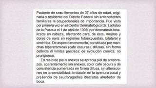 Esclerosis sitémica