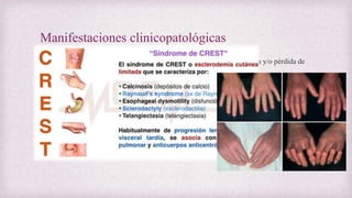 Manifestaciones clinicopatológicas
• El comienzo suele ser insidioso con dolores generalizados, rigidez, fatiga y/o pérdida de
peso.
• Fenómeno de Raynaud 90-100%.
• Alteraciones cutáneas 98-100%
• Alteraciones musculoesqueleticas 40-70%
Edematosa
Indurativa
Atrófica
 