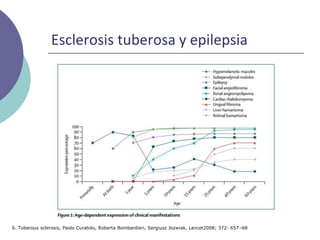 Esclerosis tuberosa y epilepsia
6. Tuberous sclerosis, Paolo Curatolo, Roberta Bombardieri, Sergiusz Jozwiak, Lancet2008; 372: 657–68
 