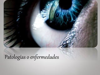 ENFERMEDADES Y
TRASTORNOS DE
LA ESCLEROTICA
Patologías o enfermedades
 