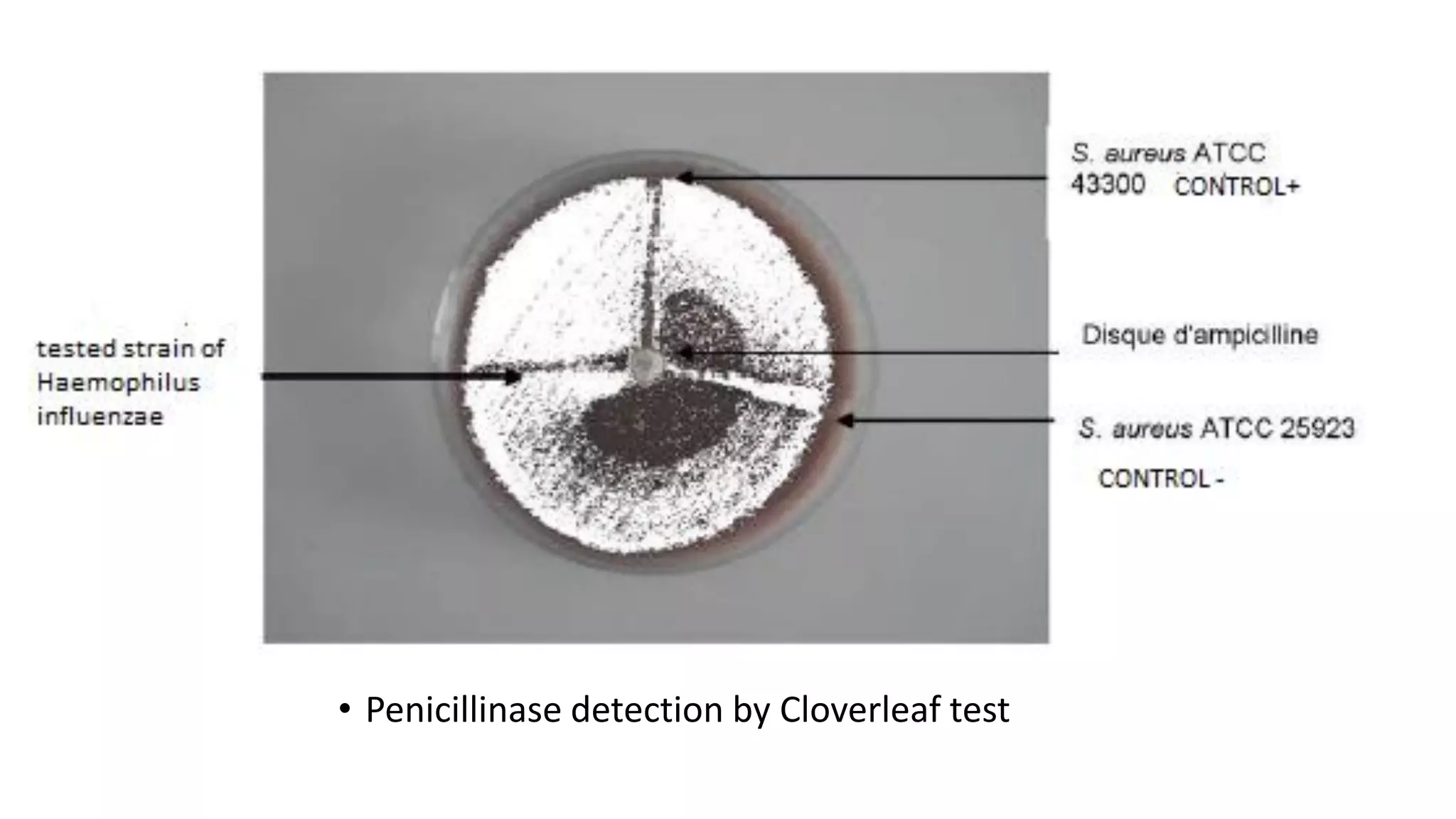 • Penicillinase detection by Cloverleaf test
 