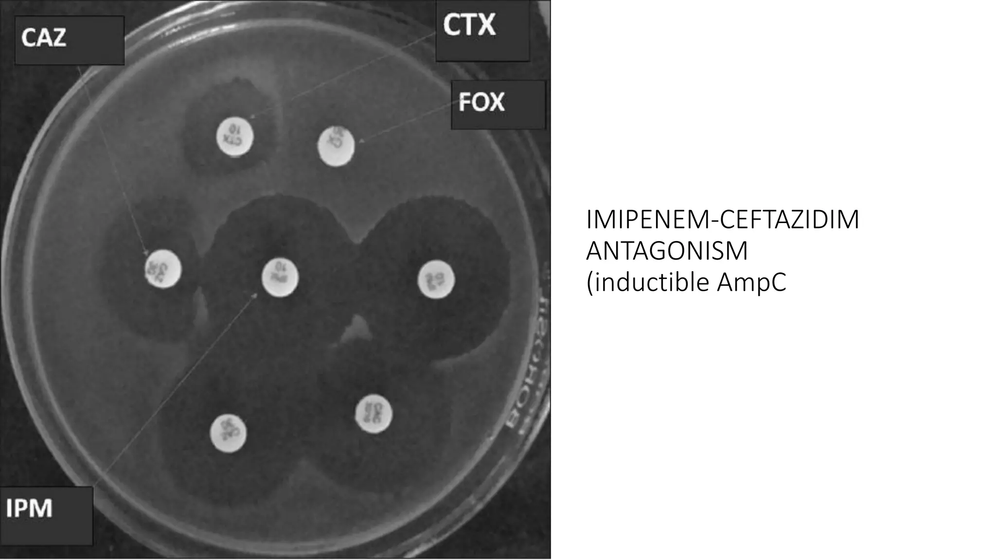 IMIPENEM-CEFTAZIDIM
ANTAGONISM
(inductible AmpC
 