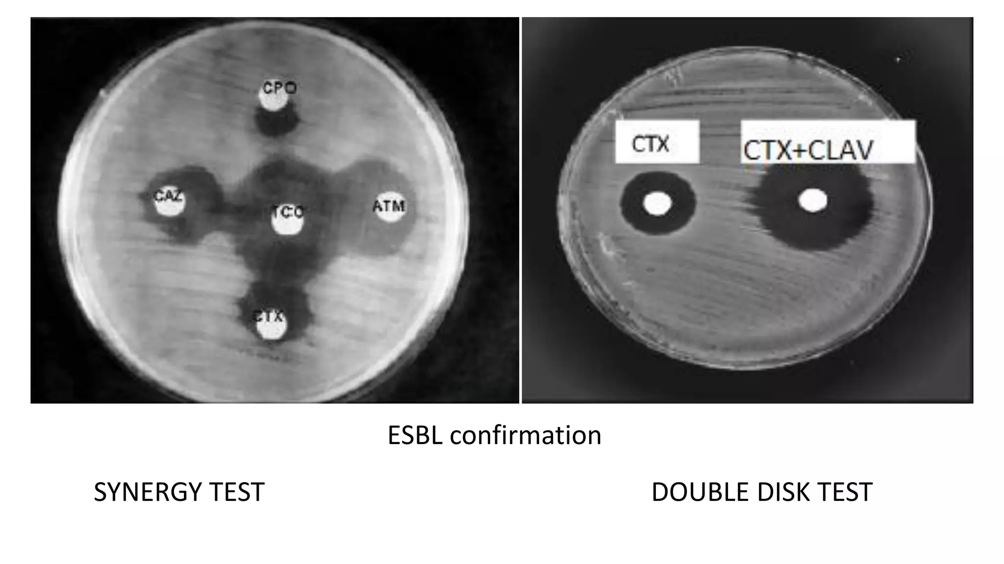 ESBL confirmation
SYNERGY TEST DOUBLE DISK TEST
 