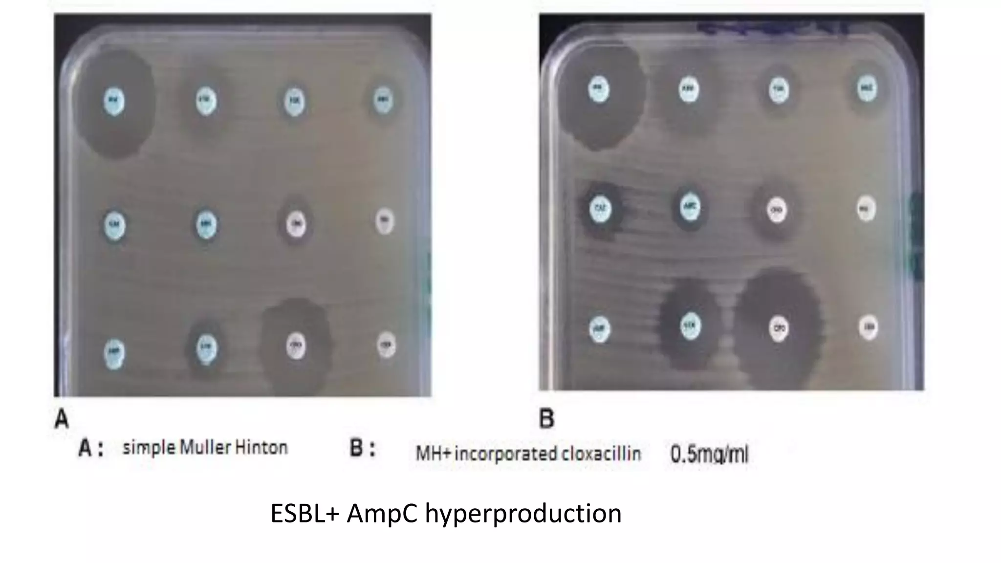 ESBL+ AmpC hyperproduction
 