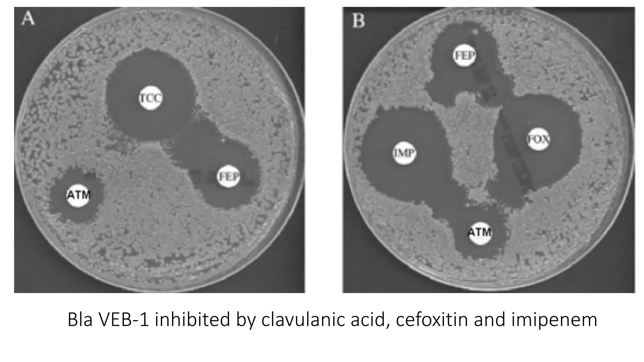 Bla VEB-1 inhibited by clavulanic acid, cefoxitin and imipenem
 