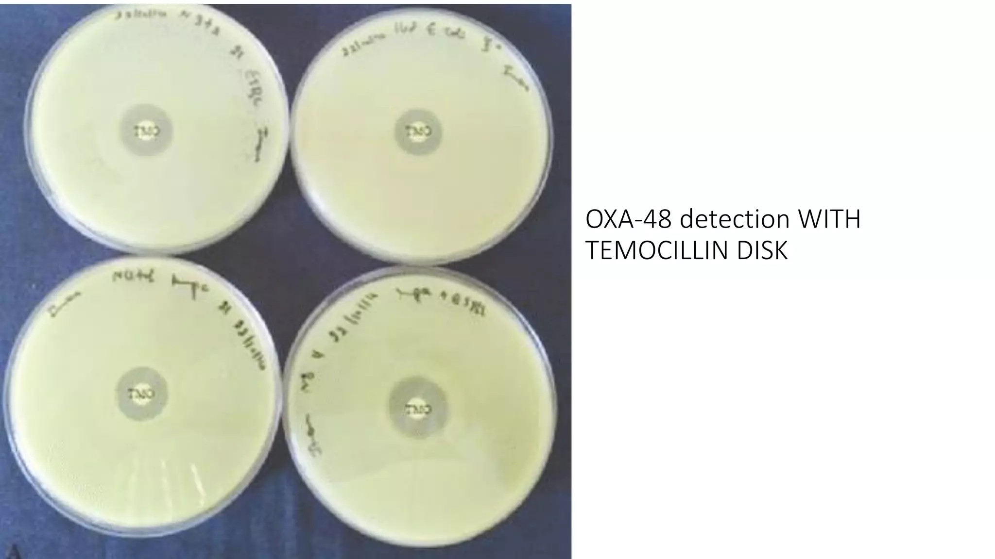 OXA-48 detection WITH
TEMOCILLIN DISK
 