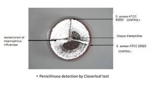 • Penicillinase detection by Cloverleaf test
 