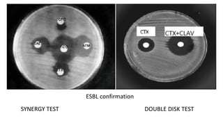 ESBL confirmation
SYNERGY TEST DOUBLE DISK TEST
 