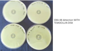 OXA-48 detection WITH
TEMOCILLIN DISK
 