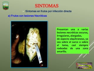  Síntomas en frutos por infección directa
a) Frutos con lesiones Necróticas
SINTOMAS
Presentan una a varias
lesiones necróticas oscuras,
irregulares, alargadas,
de aspecto alquitranoso, ya
sea sobre el surco o sobre
el lomo, casi siempre
rodeadas de una zona
amarilla.
 