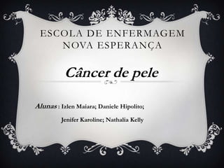 ESCOLA DE ENFERMAGEM
NOVA ESPERANÇA

Câncer de pele
Alunas : Izlen Maiara; Daniele Hipolito;
Jenifer Karoline; Nathalia Kelly

 