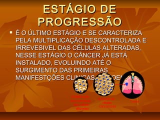 ESTÁGIO DEESTÁGIO DE
PROGRESSÃOPROGRESSÃO
 É O ÚLTIMO ESTÁGIO E SE CARACTERIZAÉ O ÚLTIMO ESTÁGIO E SE CARACTERIZA
PELA MULTIPLICAÇÃO DESCONTROLADA EPELA MULTIPLICAÇÃO DESCONTROLADA E
IRREVESIVEL DAS CÉLULAS ALTERADAS,IRREVESIVEL DAS CÉLULAS ALTERADAS,
NESSE ESTÁGIO O CÂNCER JÁ ESTÁNESSE ESTÁGIO O CÂNCER JÁ ESTÁ
INSTALADO, EVOLUINDO ATÉ OINSTALADO, EVOLUINDO ATÉ O
SURGIMENTO DAS PRIMEIRASSURGIMENTO DAS PRIMEIRAS
MANIFESTÇÕES CLINICAS DA DOENÇA.MANIFESTÇÕES CLINICAS DA DOENÇA.
 