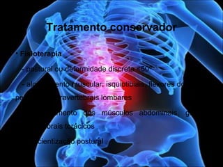 Tratamento conservador
• Fisioterapia
- postural ou deformidade discreta <50º
- alongamento muscular: isquiotibiais, flexores do quadril,
peitorais e paravertebrais lombares
- fortalecimento dos músculos abdominais, glúteos,
paravertebrais torácicos
- conscientização postural
 