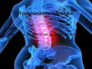 Tratamento conservador
• Colete
- Milwaukee: curvas <70º em pacientes com potencial de
crescimento
- gessado: curvas < 80º
 