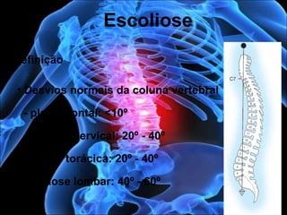 Definição
• Desvios normais da coluna vertebral
- plano frontal: <10º
- lordose cervical: 20º - 40º
- cifose torácica: 20º - 40º
- lordose lombar: 40º - 60º
Escoliose
 