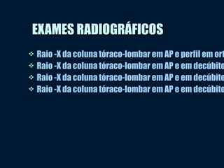 EXAMES RADIOGRÁFICOSEXAMES RADIOGRÁFICOS
 Raio -X da coluna tóraco-lombar em AP e perfil em ortRaio -X da coluna tóraco-lombar em AP e perfil em ort
 Raio -X da coluna tóraco-lombar em AP e em decúbitoRaio -X da coluna tóraco-lombar em AP e em decúbito
 Raio -X da coluna tóraco-lombar em AP e em decúbitoRaio -X da coluna tóraco-lombar em AP e em decúbito
 Raio -X da coluna tóraco-lombar em AP e em decúbitoRaio -X da coluna tóraco-lombar em AP e em decúbito
 