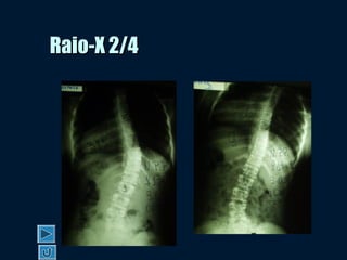 Raio-X 2/4Raio-X 2/4
 