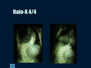 Raio-X 4/4Raio-X 4/4
 