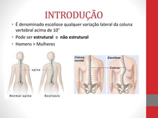 INTRODUÇÃO
• É denominado escoliose qualquer variação lateral da coluna
vertebral acima de 10°
• Pode ser estrutural e não estrutural
• Homens > Mulheres
 