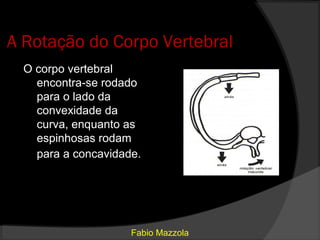 A Rotação do Corpo Vertebral
  O corpo vertebral
    encontra-se rodado
    para o lado da
    convexidade da
    curva, enquanto as
    espinhosas rodam
    para a concavidade.




                     Fabio Mazzola
 