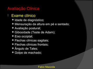 Avaliação Clínica
   Exame clínico
     Idade de diagnóstico;
     Mensuração da altura em pé e sentado;
     Avaliação postural;
     Gibosidade (Teste de Adam);
     Eixo occiptal;
     Flechas clínicas sagitais;
     Flechas clínicas frontais;
     Ângulo de Tales;
     Golpe de machado;




                     Fabio Mazzola
 
