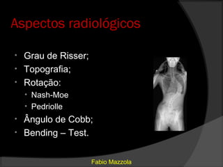 Aspectos radiológicos

• Grau de Risser;
• Topografia;
• Rotação:
    • Nash-Moe
    • Pedriolle
• Ângulo de Cobb;
• Bending – Test.


                    Fabio Mazzola
 