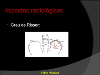 Aspectos radiológicos

•   Grau de Risser;




                      Fabio Mazzola
 