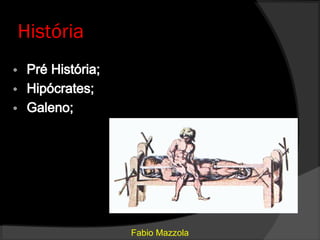 História




           Fabio Mazzola
 