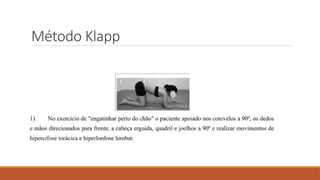 Fisioterapia Escoliose e Método Klapp.pptx