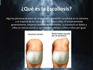 ¿Qué es la Escoliosis?Algunas personas pueden ser propensas a presentar curvaturas en la columna, y la mayoría de los casos se presenta en niñas. El encorvamiento generalmente, empeora durante el crecimiento. La escoliosis en bebés y niños es menos común y normalmente afecta a niños y niñas por igual.