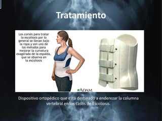 TratamientoDispositivo ortopédico que está destinado a enderezar la columna vertebral en los casos de Escoliosis. 