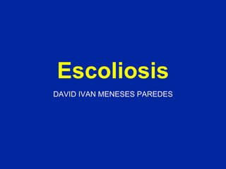 Escoliosis DAVID IVAN MENESES PAREDES 