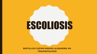 ESCOLIOSIS
BUSTILLOS CUEVAS MANUEL ALEJANDRO 496
TRAUMATOLOGÍA
 